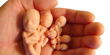 kurtaj-yaptirmak-caiz-midirhukmu-nedirb2d1e84120ce629e936b